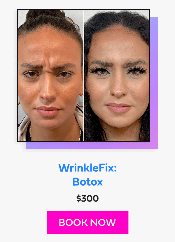 WrinkleFix: Botox