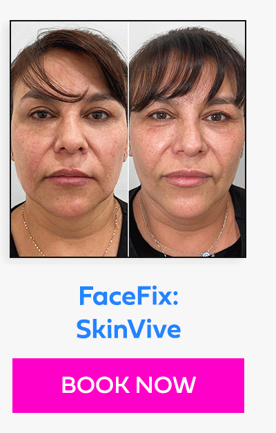 FaceFix: SkinVive