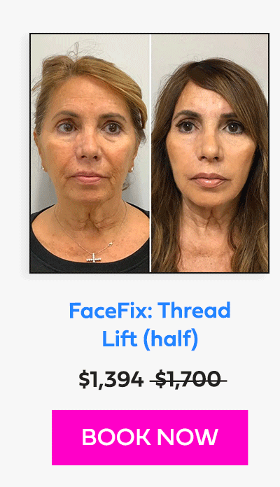 FaceFix: Thread Lift (half)