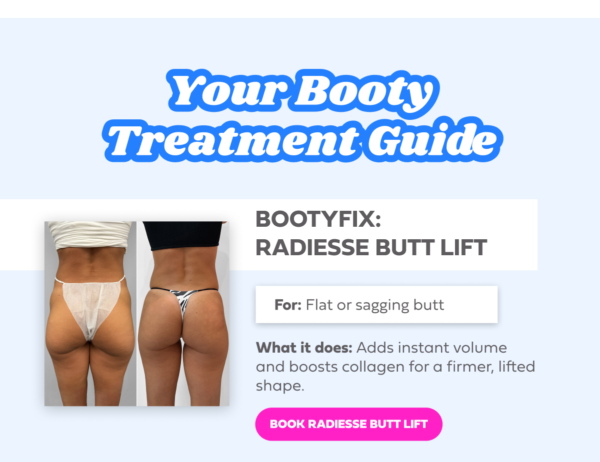 RADIESSE BUTT LIFT