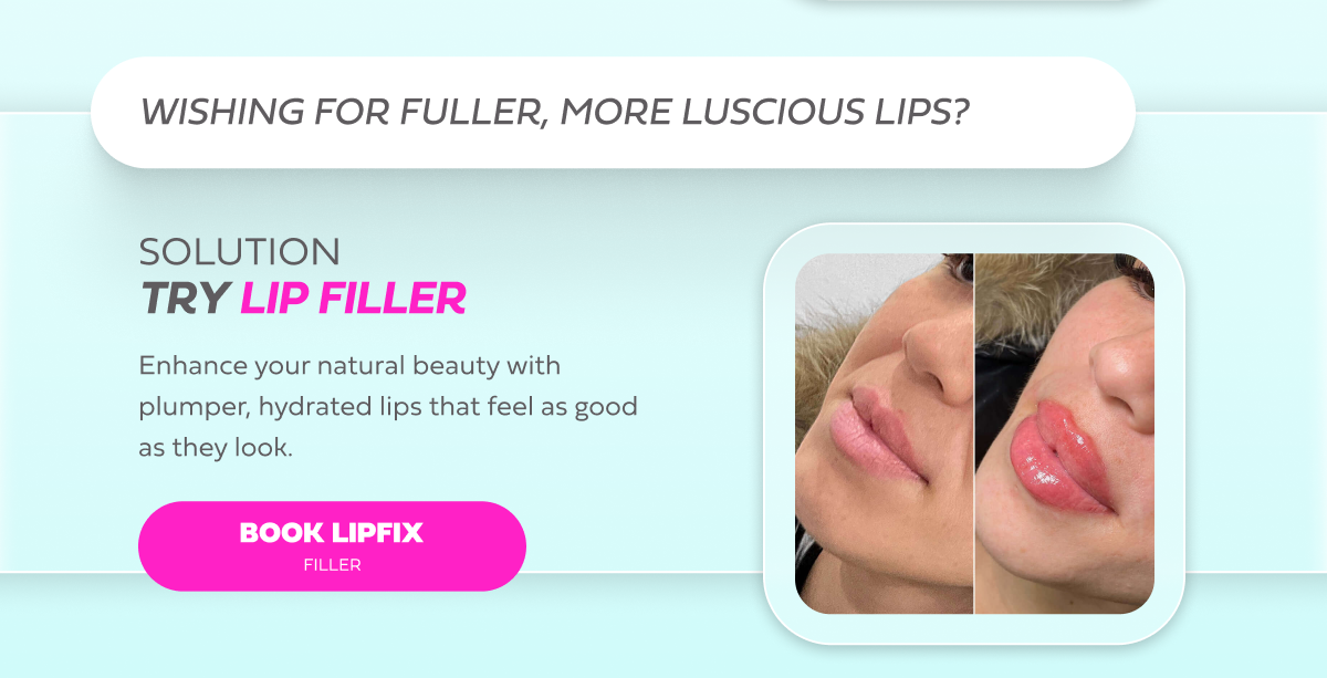 TRY LIP FILLER