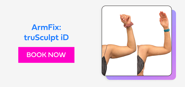 ArmFix: truSculpt iD