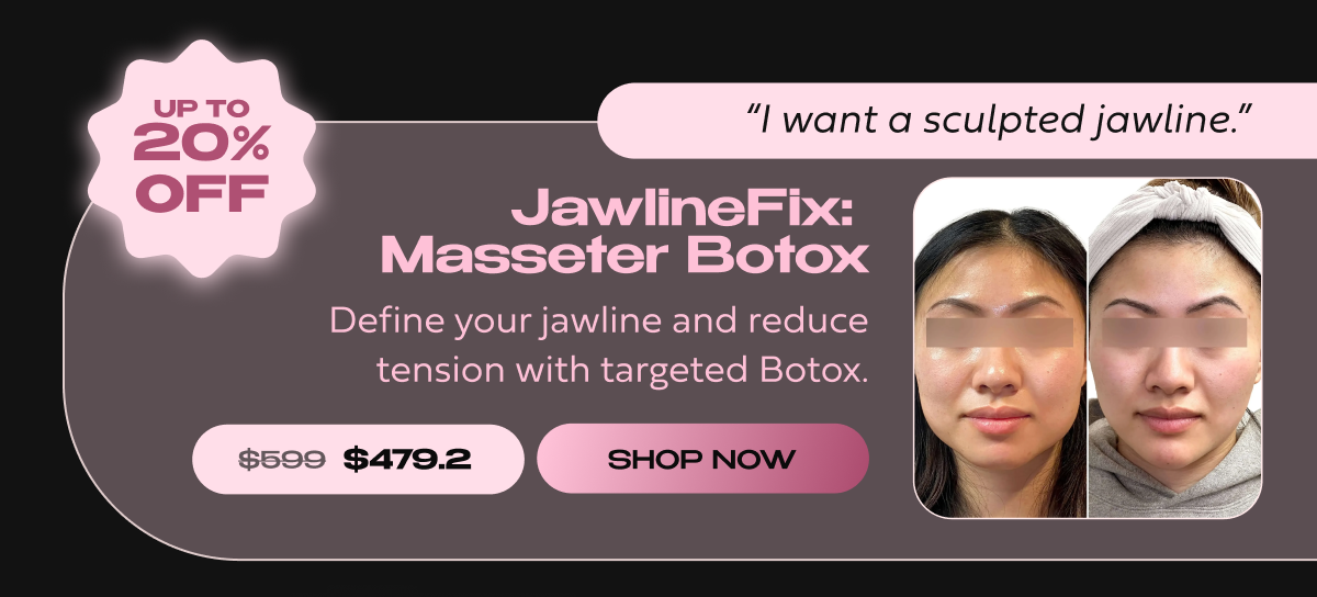 JAWLINEFIX MASSETER BOTOX