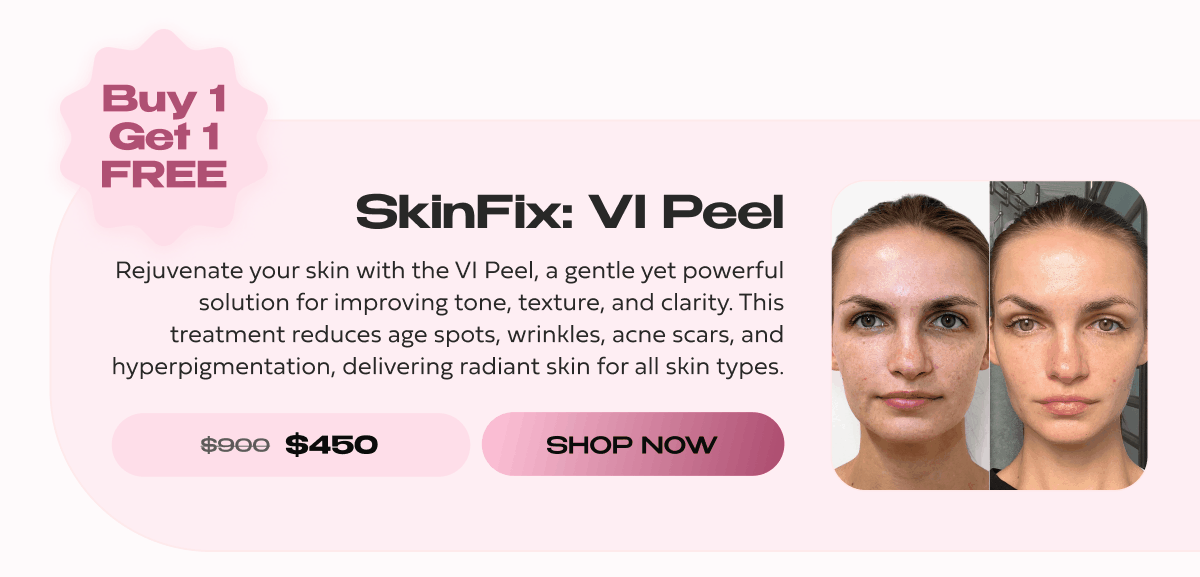 SKINFIX VI PEEL
