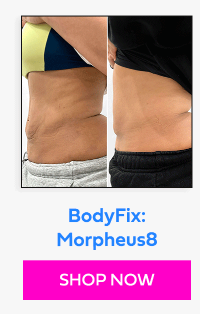BodyFix: Morpheus8
