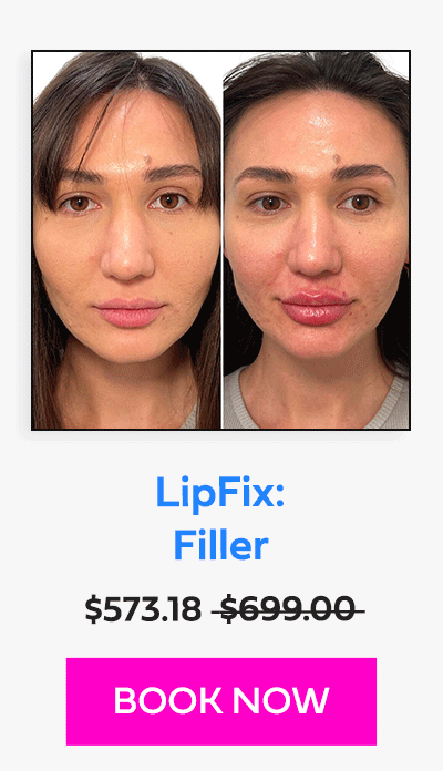 LipFix: Filler