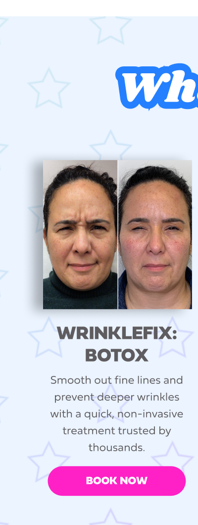 WRINKLEFIX BOTOX