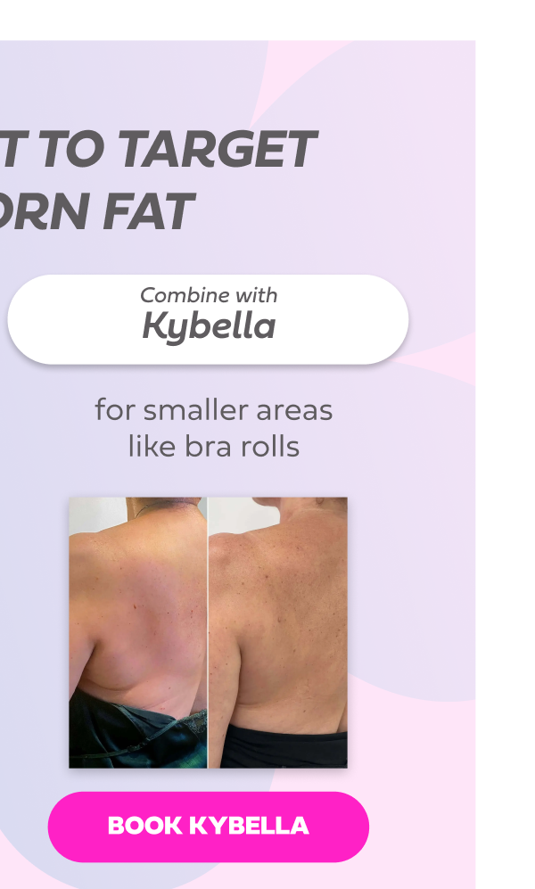 KYBELLA