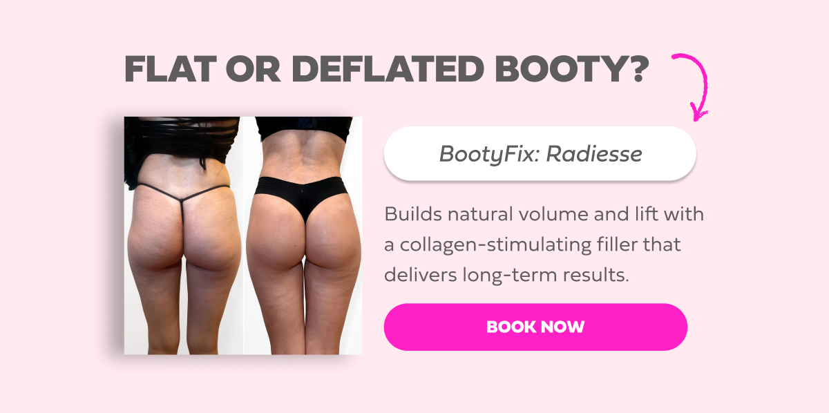 bootyfix radiesse