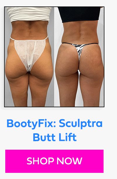 BootyFix: Sculptra Butt Lift