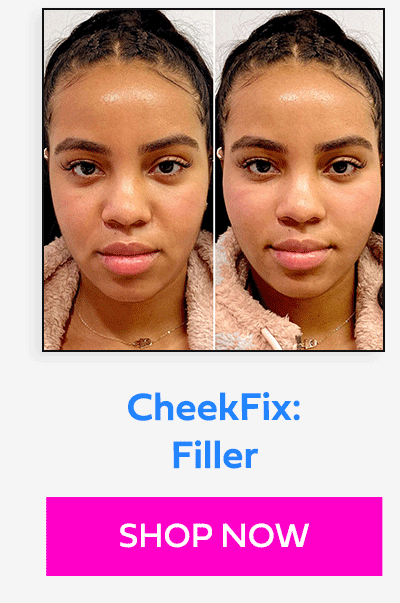 CheekFix: Filler