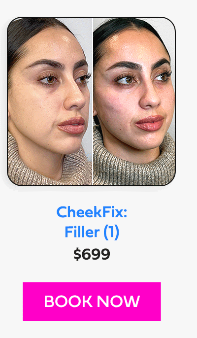 CheekFix: Filler (1)
