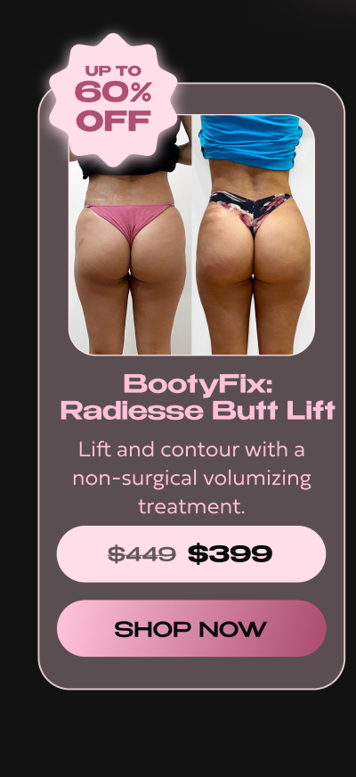 BOOTYFIX RADIESSE BUTT LIFT