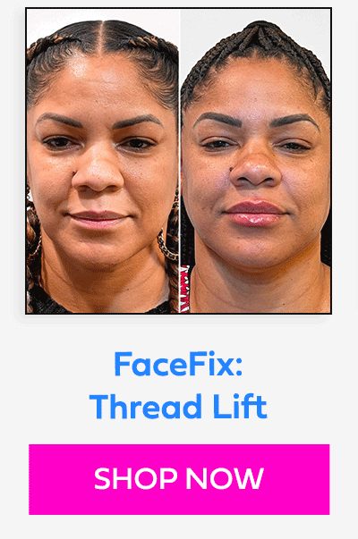 FaceFix: Thread Lift