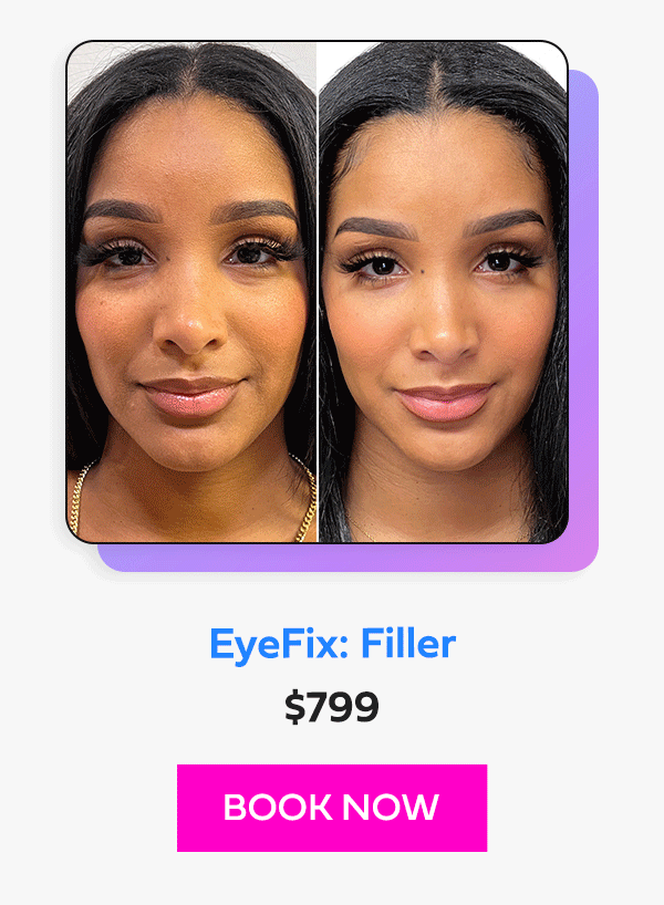 EyeFix: Filler