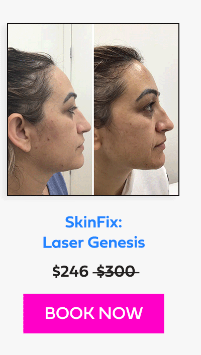 SkinFix: Laser Genesis