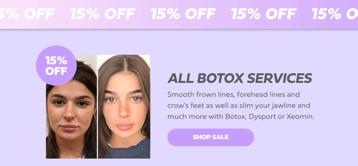 ALL BOTOX SERVICES