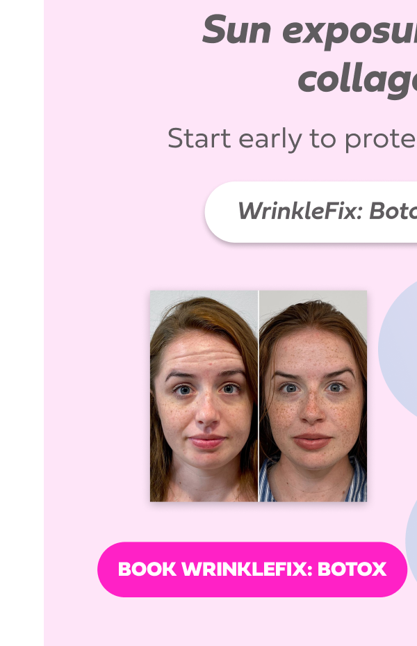 WRINKLEFIX BOTOX