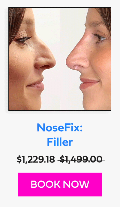 NoseFix: Filler
