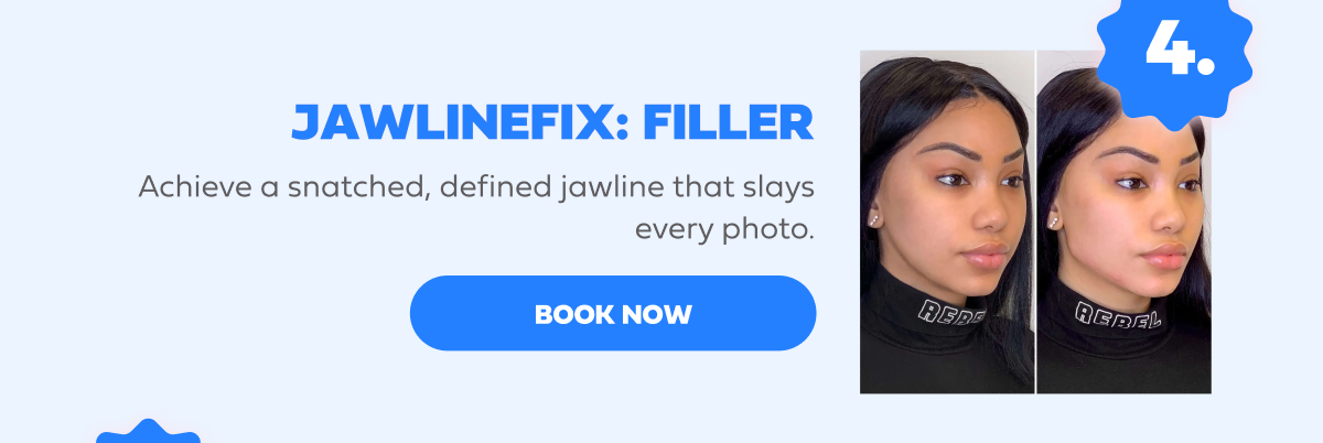 JAWLINEFIX FILLER