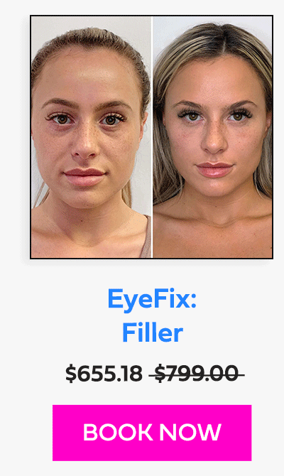 EyeFix: Filler