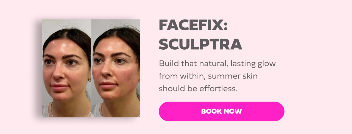 FACEFIX SCULPTRA