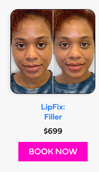 LipFix: Filler