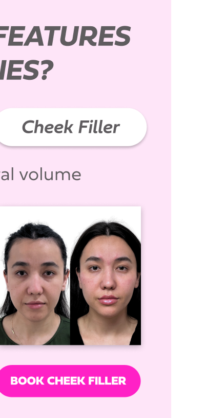 CHEEK FILLLER