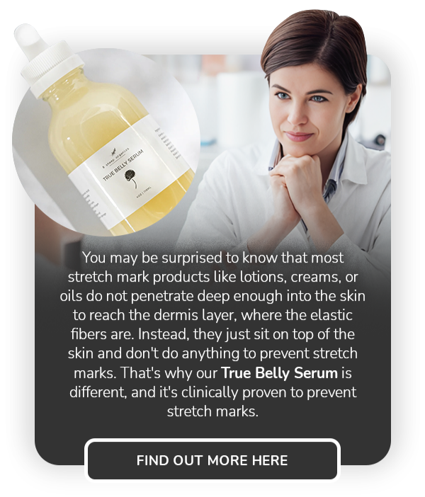 Say Goodbye to Stretch Marks, Mama 8 Sheep Organics