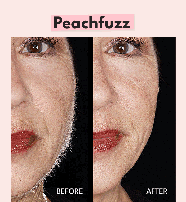 Real People Before & After IMAGES! Hollywood Browzer