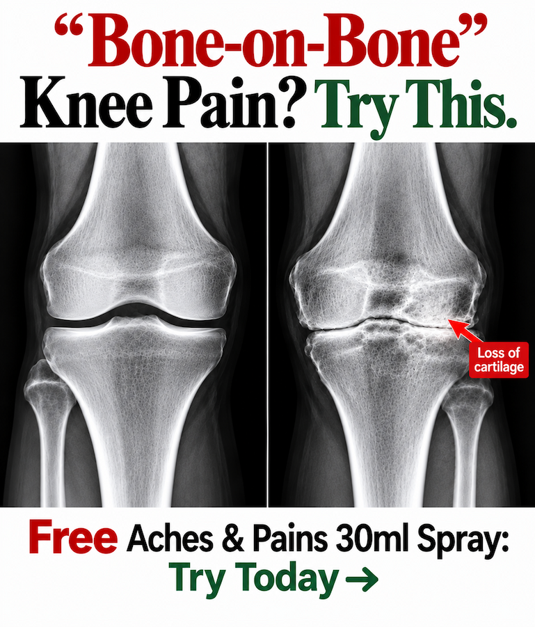 Bone-on-bone knee pain? Free Aches & Pains 30ml Spray.