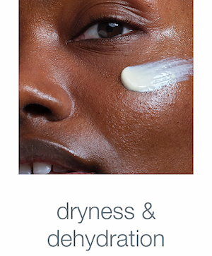 dryness & dehydration