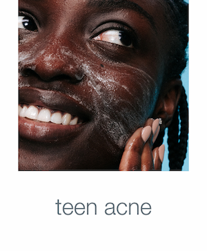 teen acne