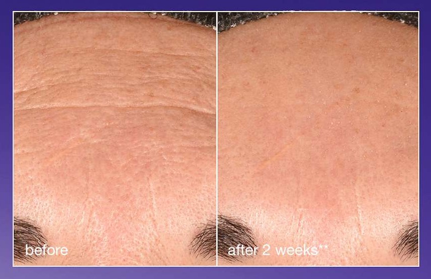 regnerating daily leave on | improves skin's natural regeneration by 86%* | before | after 2 weeks** | *versus untreated skin. based on in vitro testing. ** results on days 1 and 14 of an 8-week independent clinical study with 32 subjects, 2 applications/day.