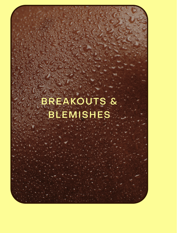Breakouts & blemishes