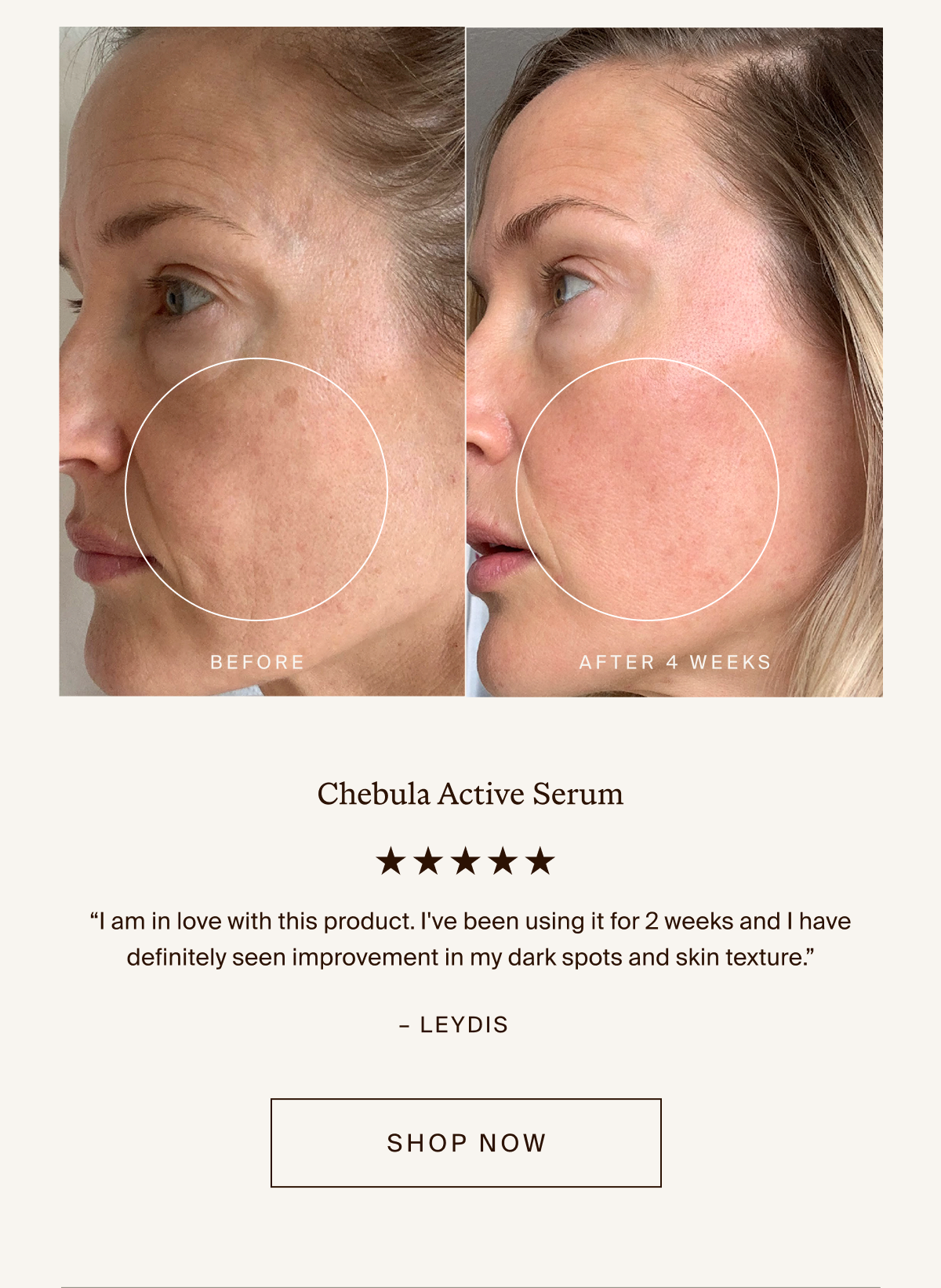 Chebula Active Serum