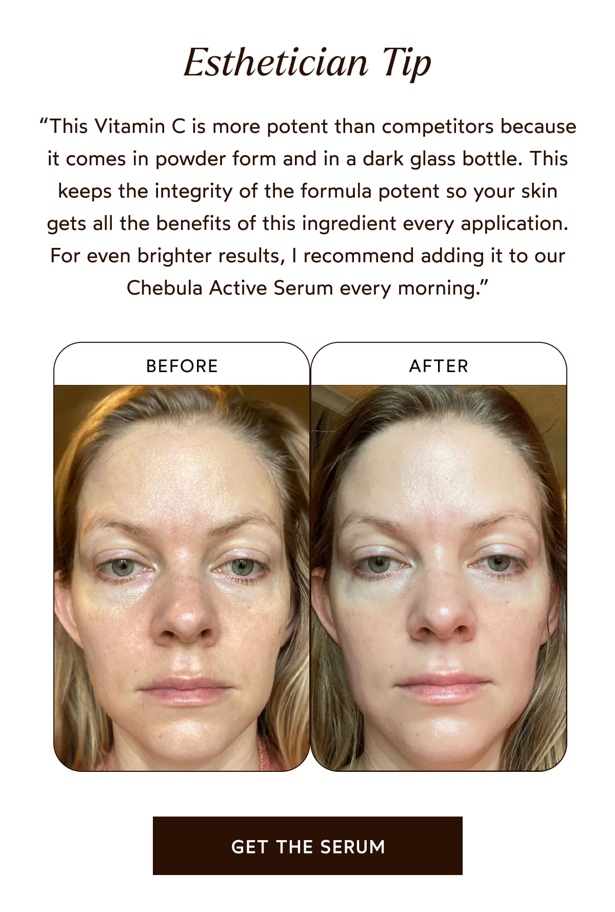 Esthetician Tip: For even brighter results, I recommend adding it to our Chebula Active Serum every morning.”  [Click here to Get The Serum]