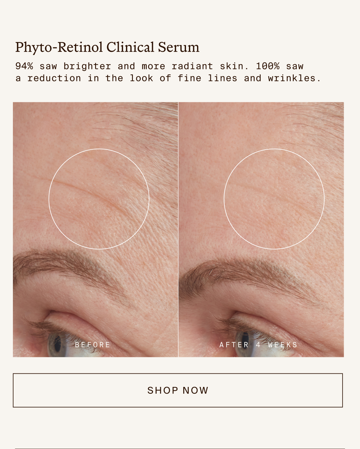 Phyto-Retinol Clinical Serum