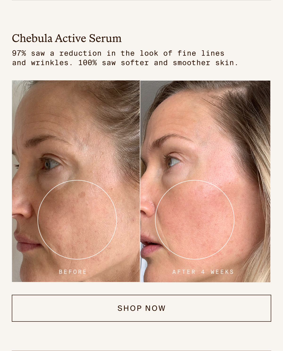 Chebula Active Serum