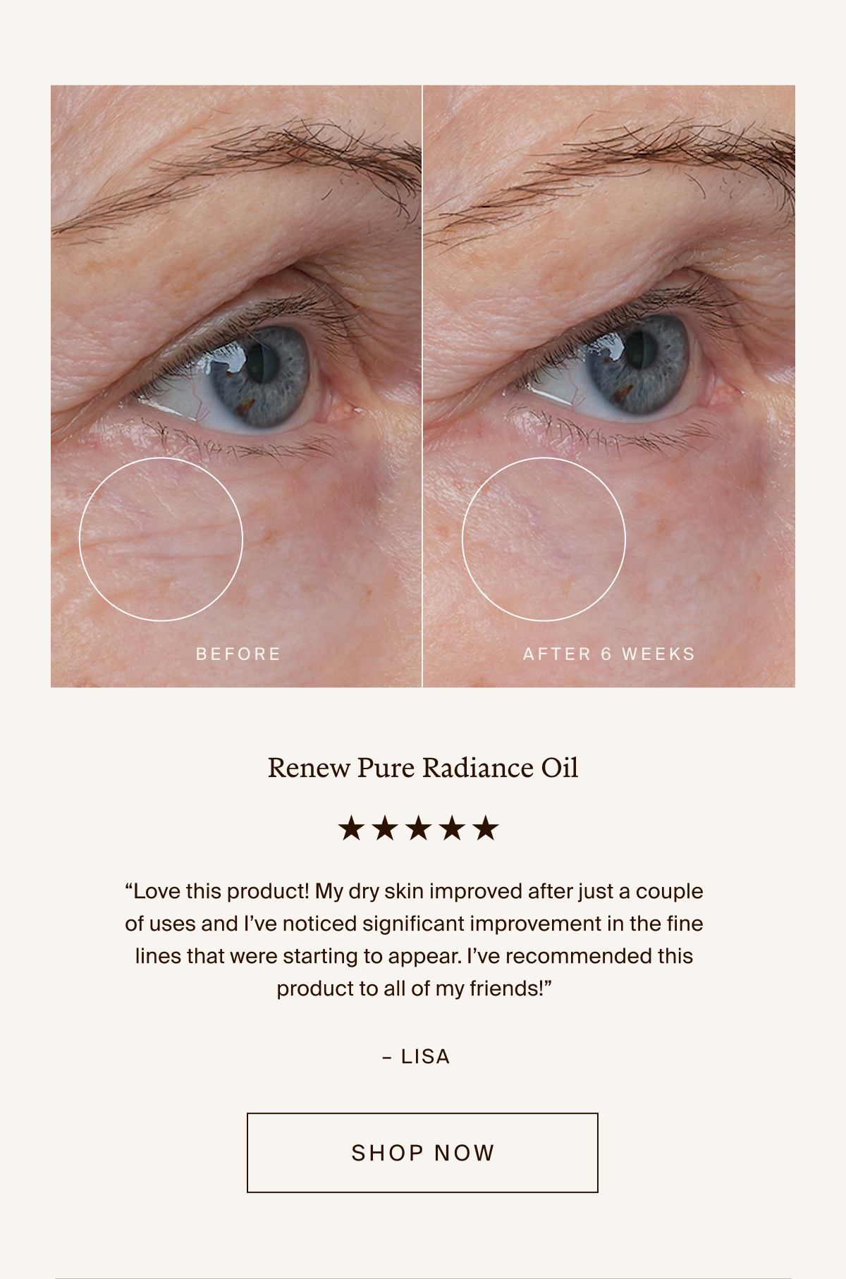 Renew Pure Radiance Oil
