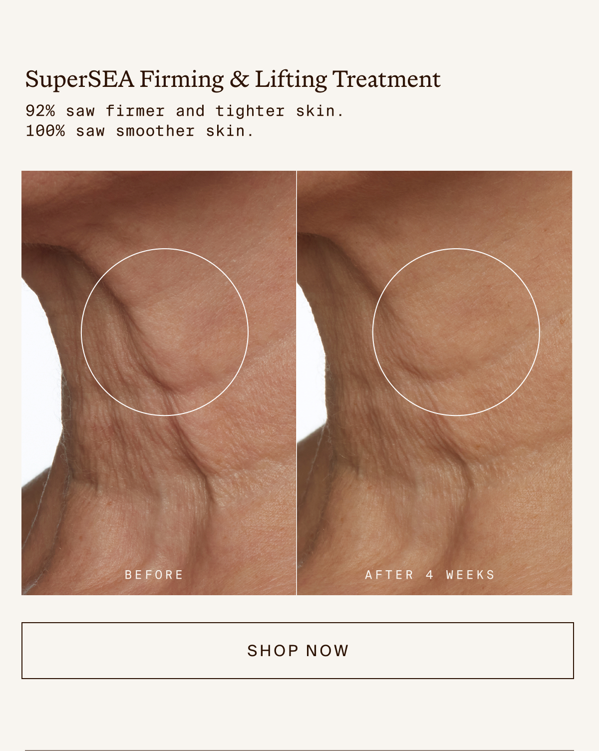 SuperSea Firming & Lifting Treatment
