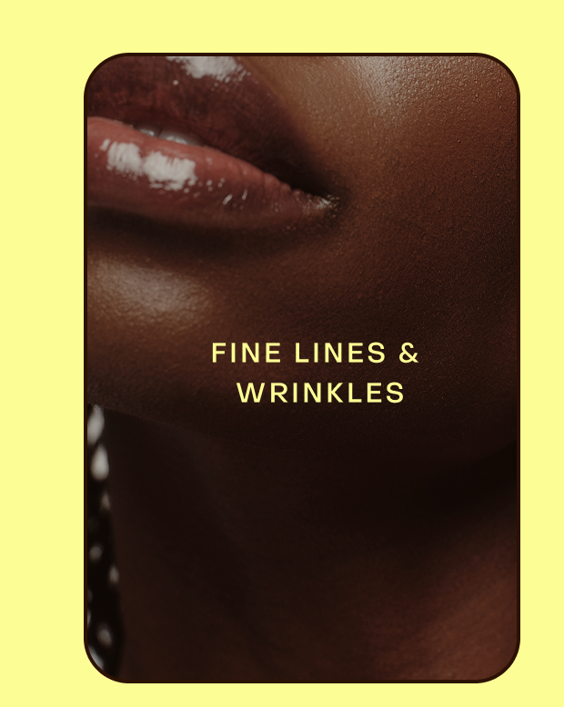 Fine lines & wrinkles