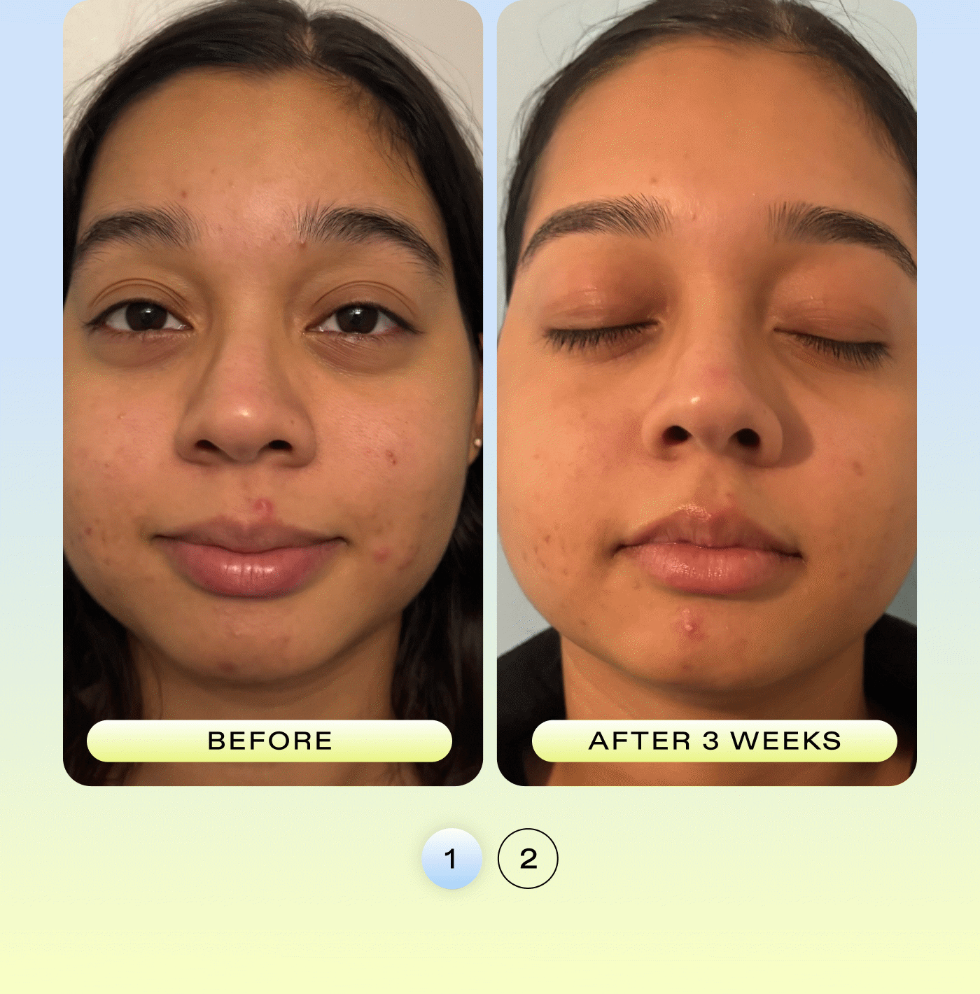 Before and After