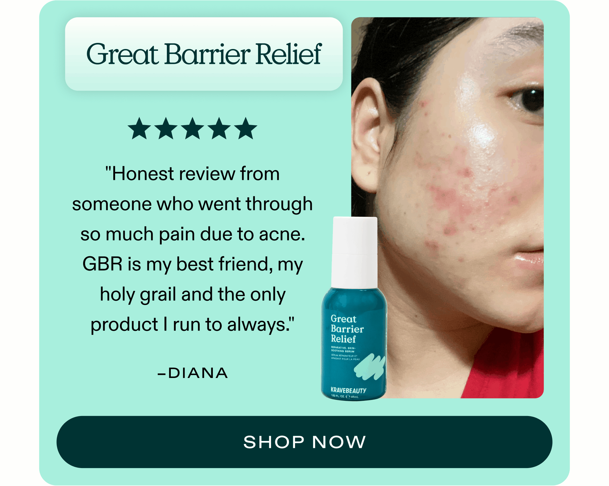 Great Barrier Relief ⭐⭐⭐⭐⭐ "I've been using this product for just 2 weeks, and it already does what my 10-step routine couldn't. I'm talking skin cleared, reduced irritation, and no more flare-ups!" - Manuela  |  SHOP  NOW