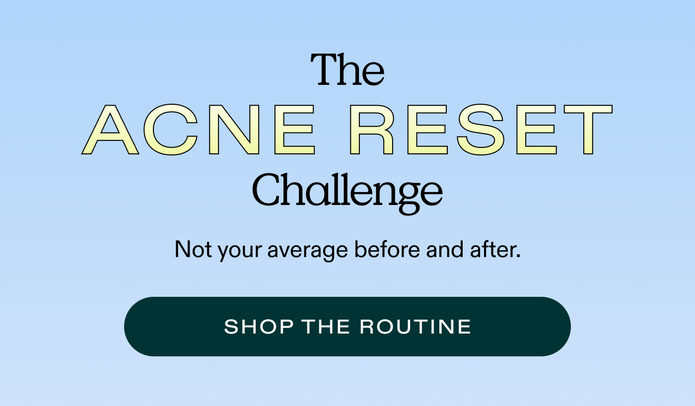 THE ACNE RESET CHALLENGE.  Not Your Average Before & After  |  SHOP THE ROUTINE