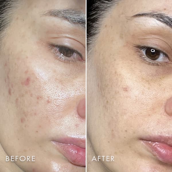 REPAIR SERUM NAC Y²™