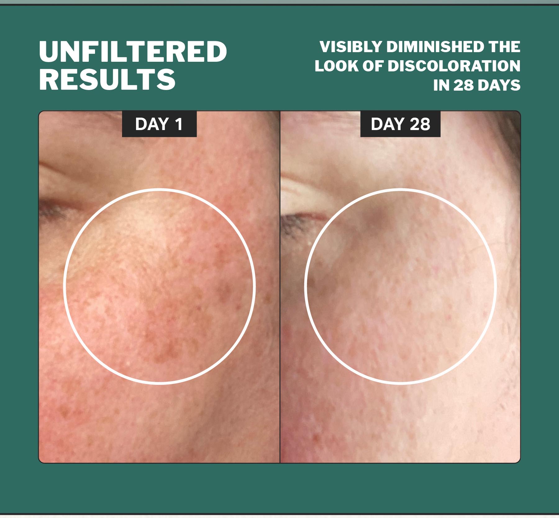 NEW! chlorophyll discoloration serum 🌿 Cocokind