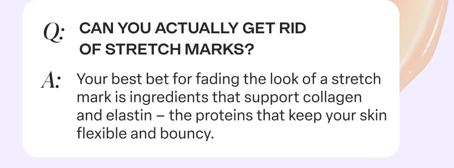 Your best bet for fading the look of stretch marks is...
