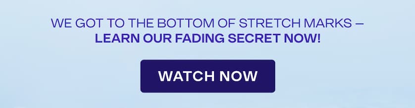 We got to the bottom of stretch marks - learn our fading secret now! WATCH NOW