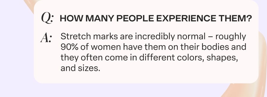90% of women have stretch marks.